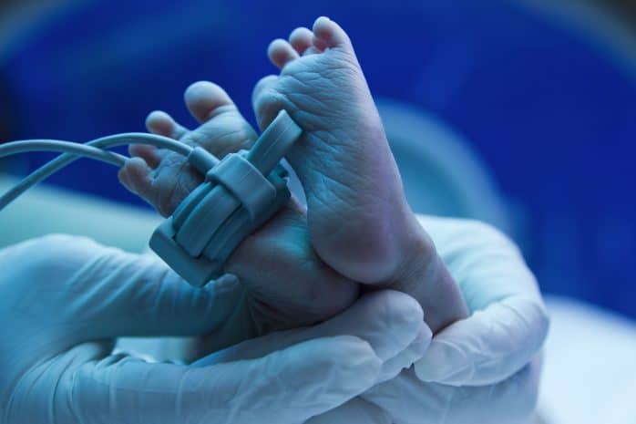 ittero neonatale fototerapia