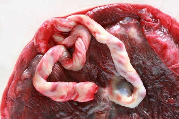 placenta