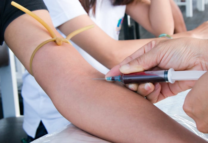 prelievo sangue