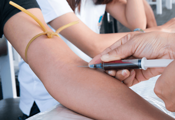 I latticini potrebbero essere un aiuto contro il diabete x